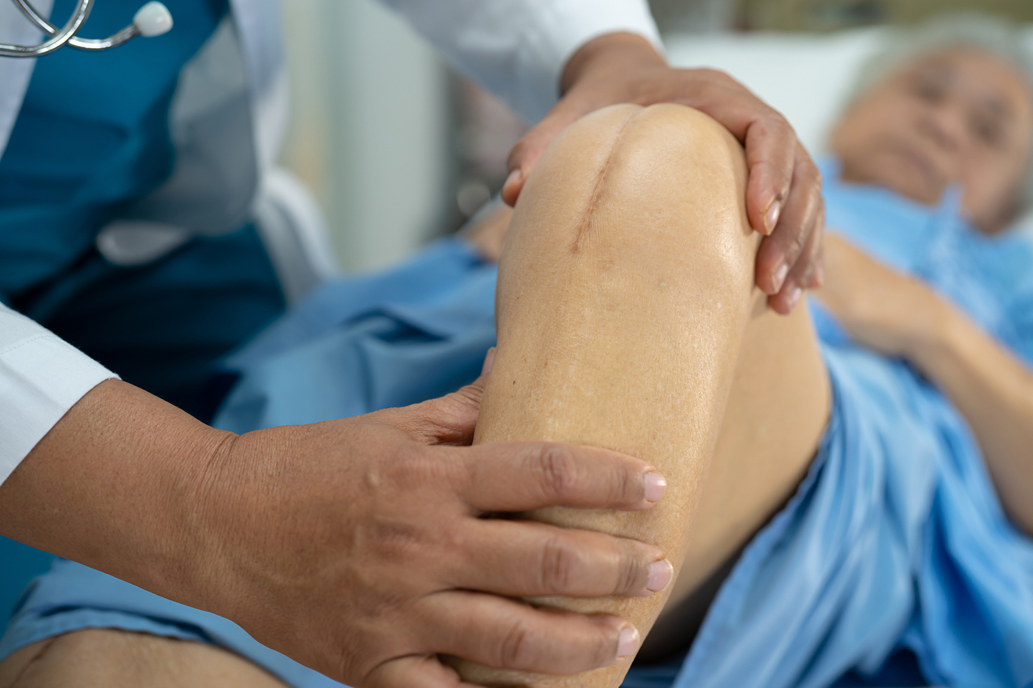 Knee Replacement Surgery